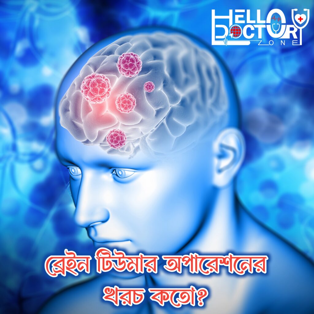 ঢাকায় ব্রেন টিউমার অপারেশনের খরচ কত ? ব্রেন টিউমার নির্ণয়ের সাথে মোকাবিলা করা মানসিক এবং আর্থিকভাবে উভয়ই অপ্রতিরোধ্য হতে পারে। মস্তিষ্কের টিউমার অপারেশনের খরচ বোঝা পরিকল্পনা এবং উপযুক্ত চিকিৎসা সেবা চাওয়ার একটি গুরুত্বপূর্ণ দিক। এই নিবন্ধে, আমরা ঢাকায় ব্রেন টিউমার অপারেশনের খরচ সম্পর্কে বিস্তারিত আলোচনা করব।