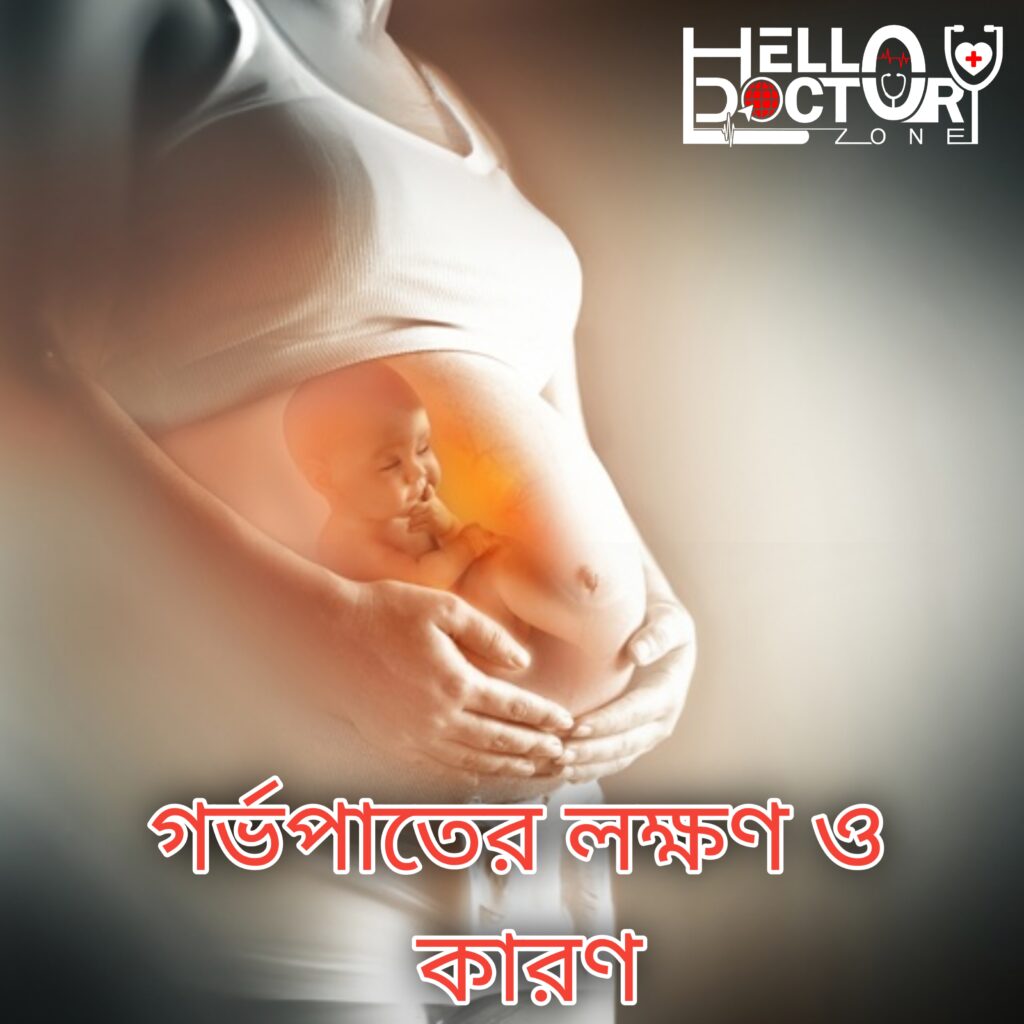 গর্ভপাতের লক্ষণ ও কারণ মেডিকেল রিভিউ করেছেন ডা. সেঁজুতি সীমান্ত একটি গবেষণায় দেখা গিয়েছে যে, গর্ভধারণ নিশ্চিত হওয়ার পরে শতকরা ১০ ভাগ ক্ষেত্রে গর্ভাবস্থার পরিণতি গর্ভপাত হয়ে থাকে। তাছাড়া অনেক ক্ষেত্রে গর্ভধারণ নিশ্চিত হওয়ার পূর্বেই গর্ভপাত হয়ে যায়। সাধারণত প্রথম ত্রৈমাসিকে গর্ভপাত হওয়ার ঝুঁকি তুলনামূলক বেশি। মা ও শিশুর স্বাস্থ্য এবং আশেপাশের স্বাস্থ্য সেবা প্রদানকারী কেন্দ্রের চিকিৎসা ব্যবস্থার সক্ষমতার ওপর ভিত্তি করে প্রত্যেক শিশুর বাইরের জগতে বেঁচে থাকার জন্য প্রস্তুত হতে সময় কিছুটা কম-বেশি লাগতে পারে। তাই গর্ভপাতের সময়সীমা একেক দেশে একেক রকম হয়। বাংলাদেশের প্রেক্ষাপটে এবং বিশ্ব স্বাস্থ্য সংস্থার মতে গর্ভাবস্থার ২৮ সপ্তাহ সম্পূর্ণ হওয়ার আগে গর্ভের সন্তান মারা গেলে তাকে গর্ভপাত বলে। অপরদিকে ২৮ সপ্তাহের পর গর্ভে সন্তানের মৃত্যু ঘটলে তাকে মৃতপ্রসব বলা হয়।